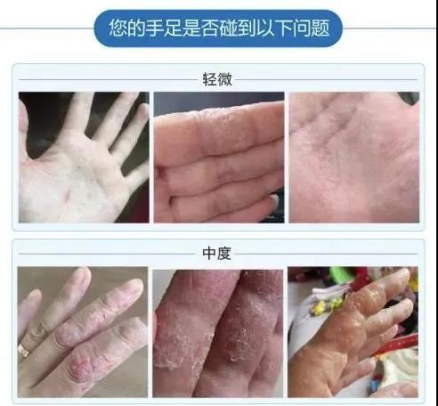 偏门项目：脱皮偏方赚钱术，抓住这波机会你也能小赚一笔！-偏门行业网